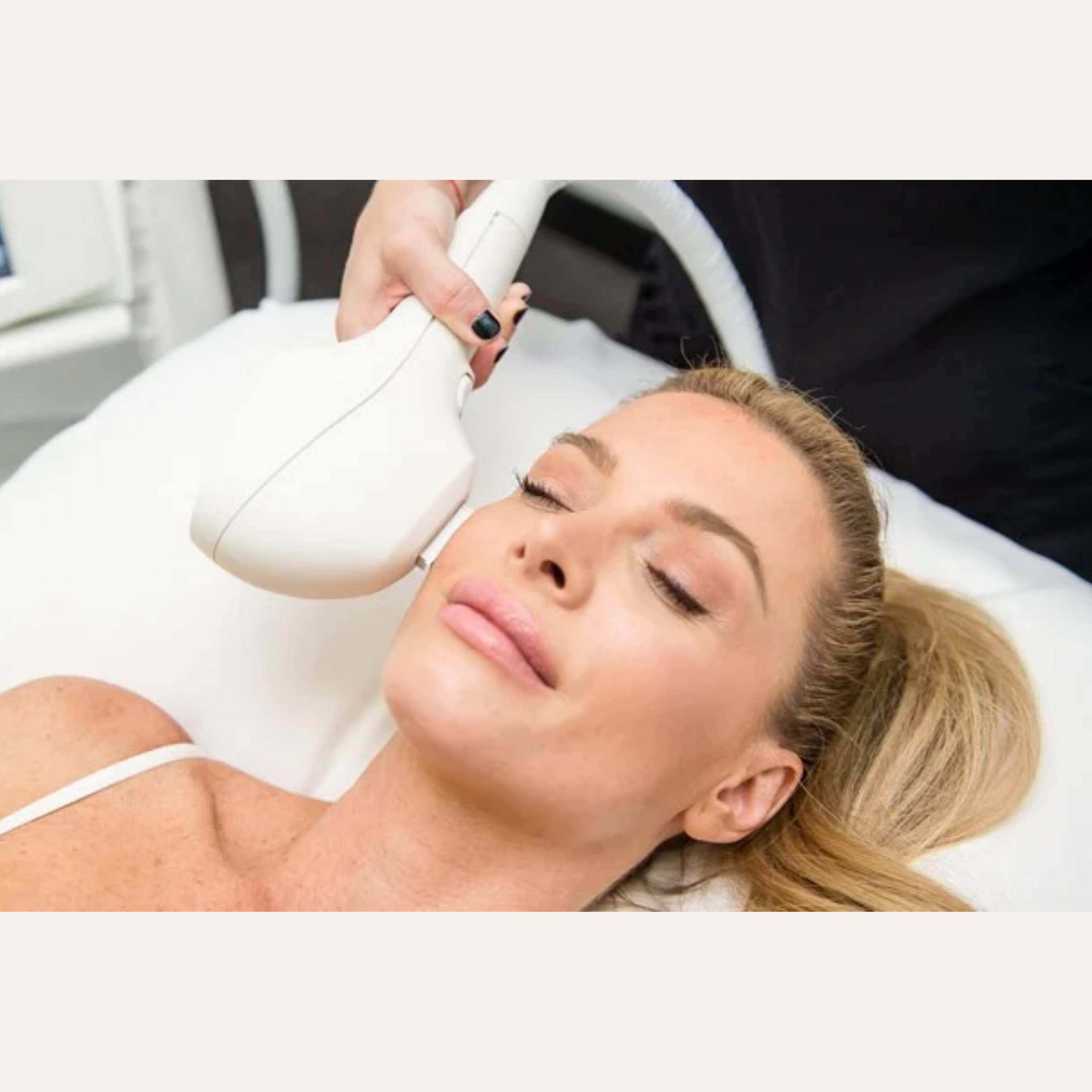 Traitement IPL au Salon Chantale